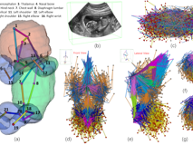 草莓视频
倪东教授团队在《Medical Image Analysis》上发表文章