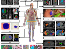 草莓视频
倪东教授团队在《Medical Image Analysis》上发表文章