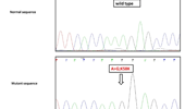 Mitochondrial ND1 mutations and HSP60 and HSP70 mRNA expressions in patients with schizophrenia